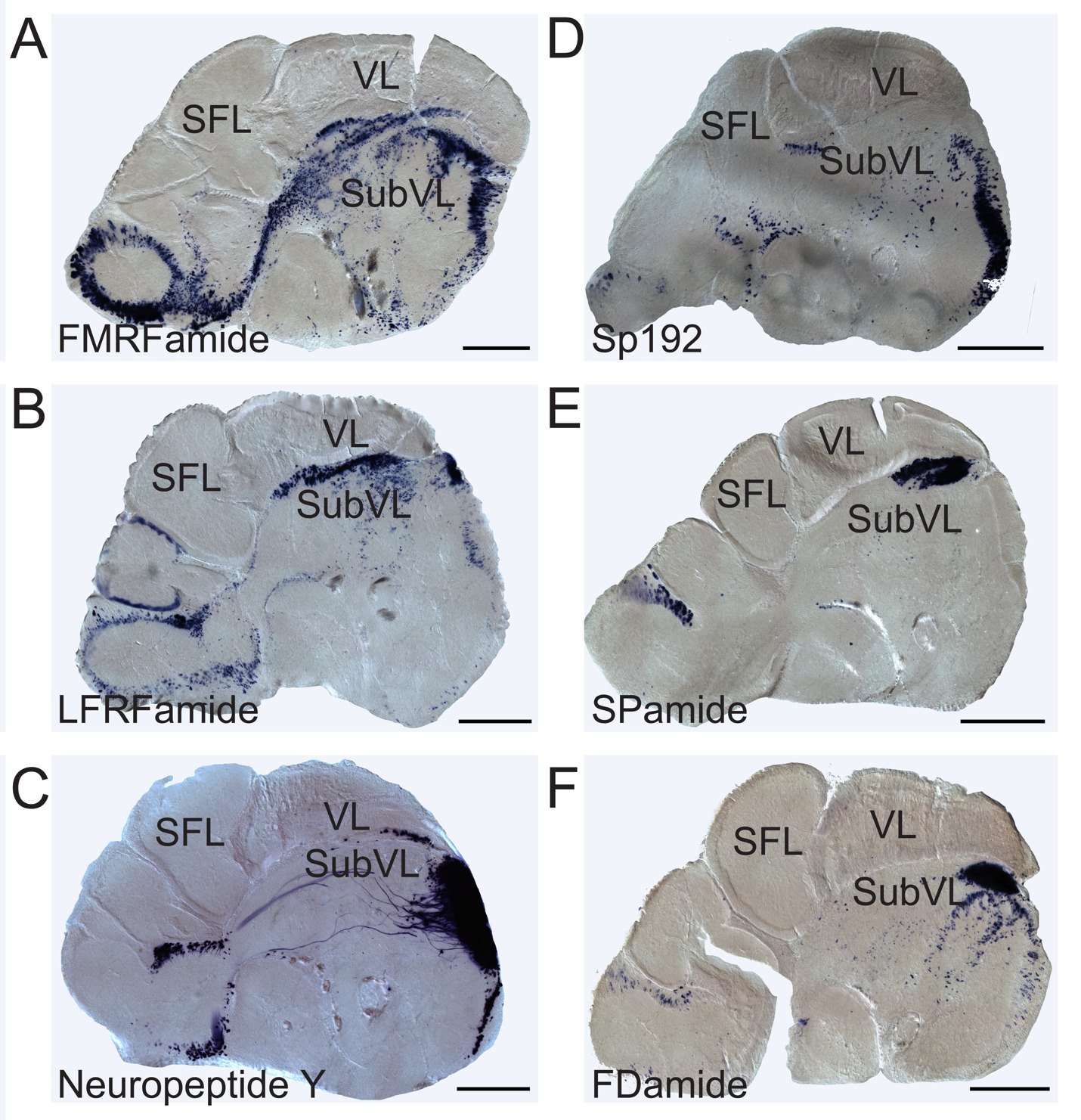 Six sagittal sections of the octopus supraesophageal brain, each stained for a different neuropeptide transcript