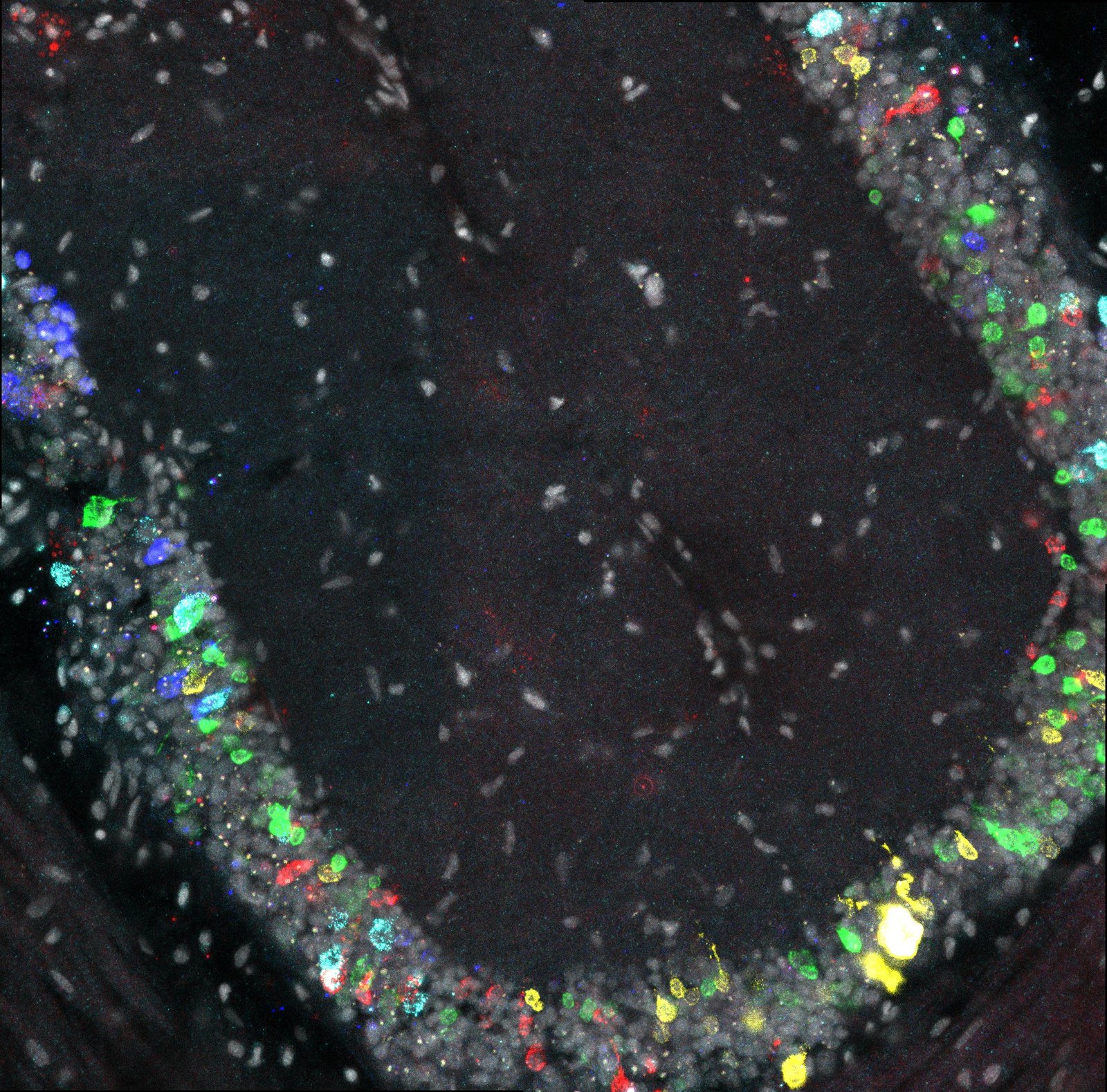 Multiplexed HCR: coloured neuronal populations around a ganglion of the axial nerve cord